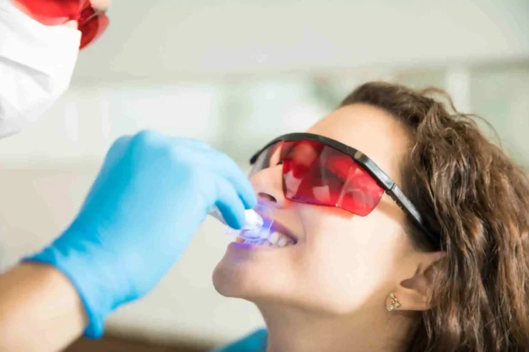 Laser Teeth Whitening & Polishing